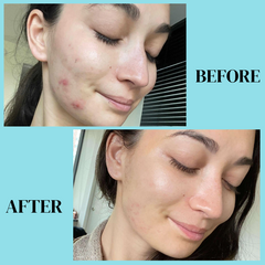 Hyaluronic Acid 2% Vitamin B5 Face Serum By Dr. Bisma