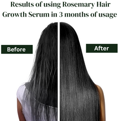 Rosemary Hair Growth Serum By Dr. Bisma