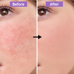 Niacinamide 10% Zinc 1% Nico Face Serum By Dr. Bisma