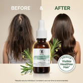 Rosemary Scalp Treatment By Dr. Bisma