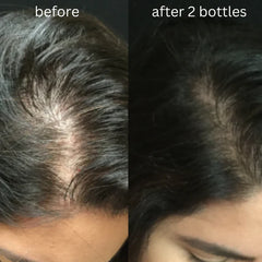 Protein Hair Treatment Oil By Dr. Bisma