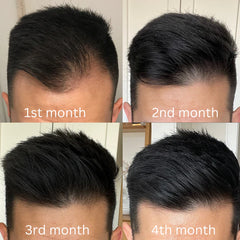 Protein Hair Treatment Oil By Dr. Bisma