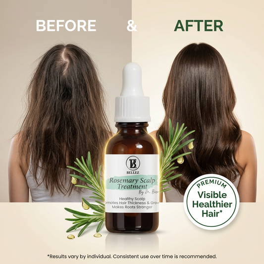 Rosemary Scalp Treatment By Dr. Bisma