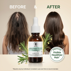 Rosemary Scalp Treatment By Dr. Bisma